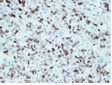 Fig 1E